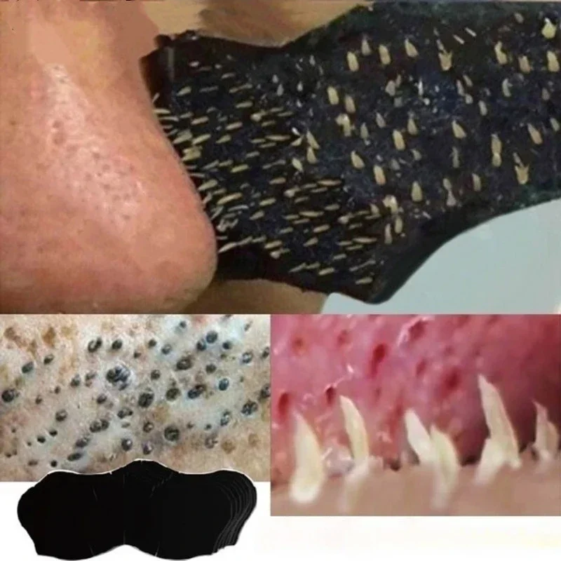 Charcoal Pore Strip - Unisex Blackhead Remove Mask Nasal Strips