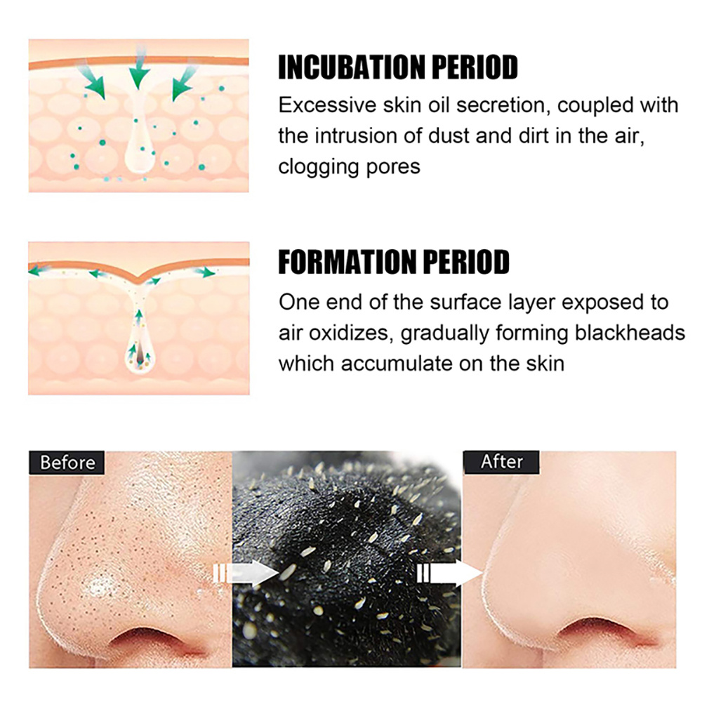 10/20/50/100 Pieces Deep Clean - Charcoal Pore Strip ulasan dan harga