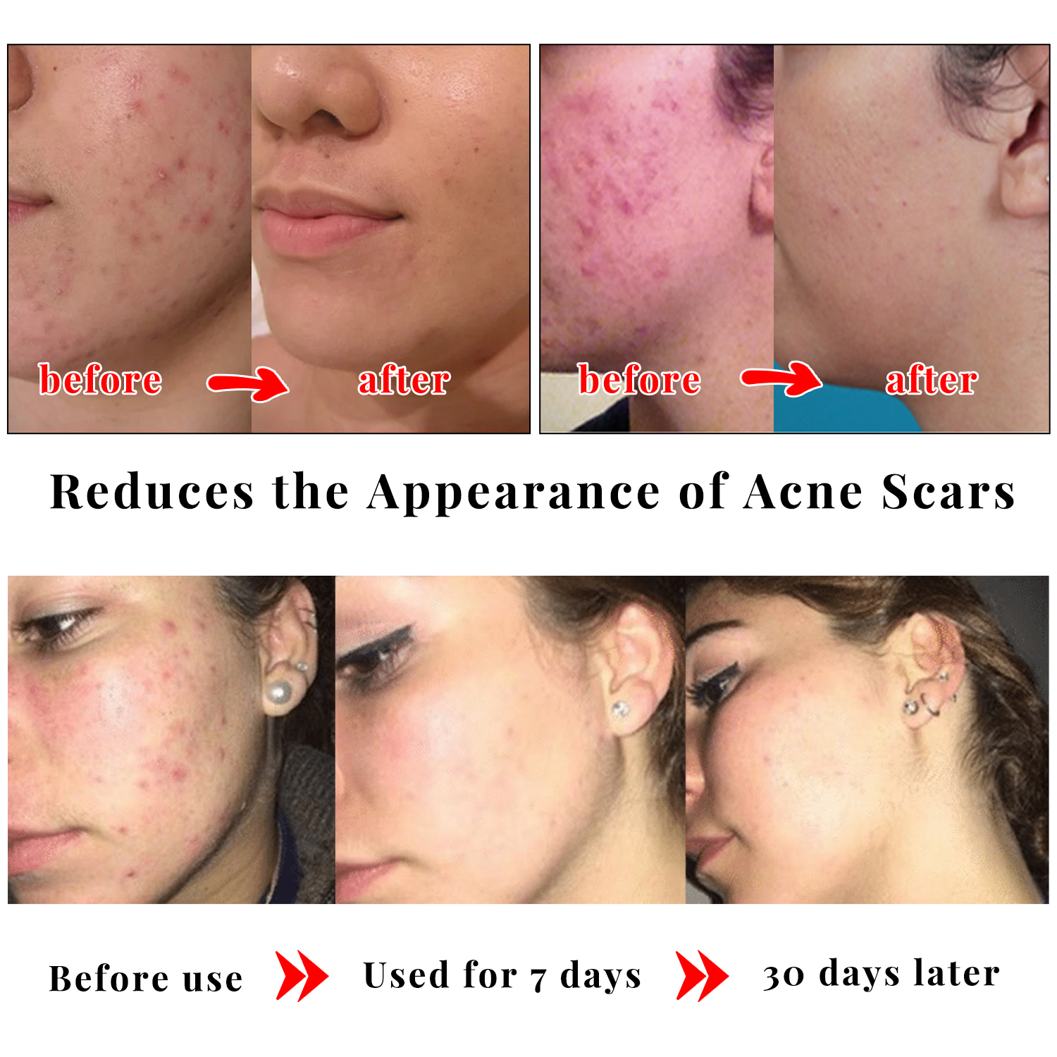 Kojic Acid Glow Soap Facial De - Skincare X2 ulasan dan harga