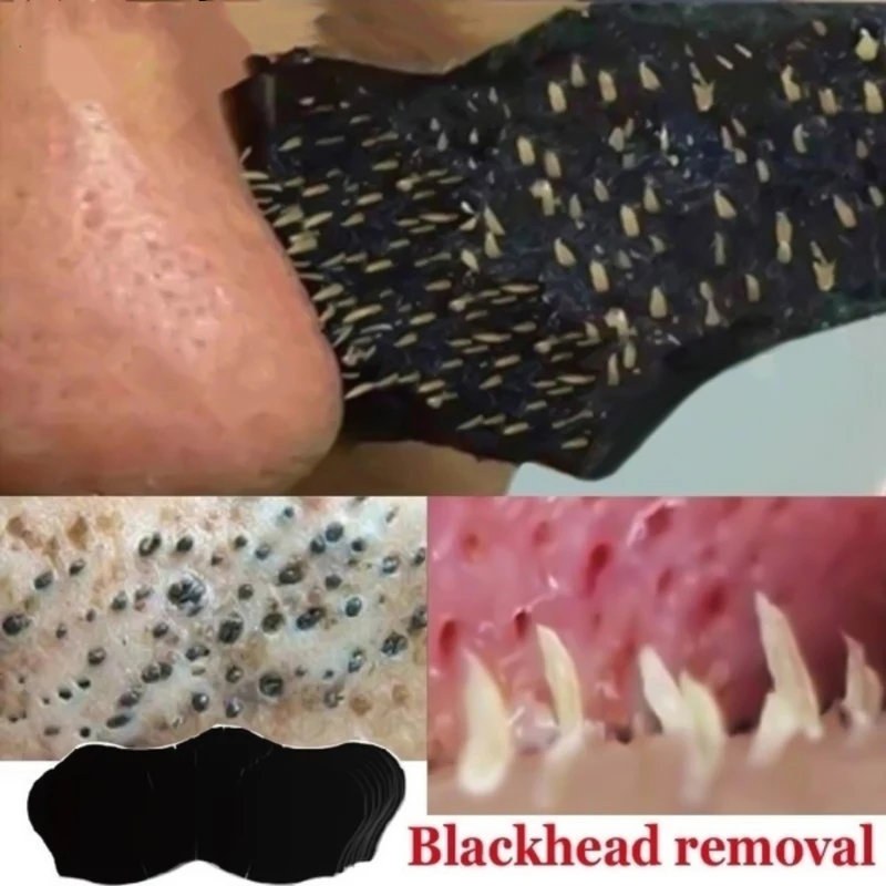 10-50pcs Nose Strips For Black - Charcoal Pore Strip ulasan dan harga