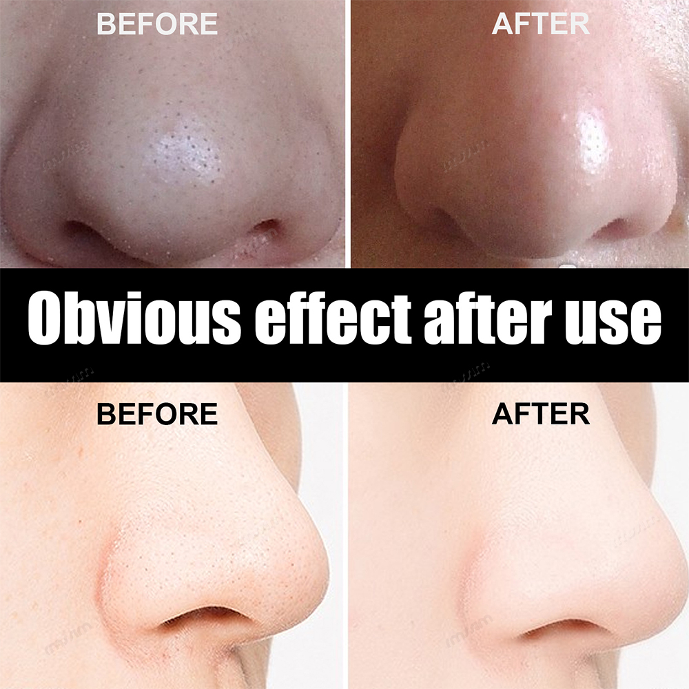 New 10-100pcs Unisex Blackhead - Charcoal Pore Strip ulasan dan harga